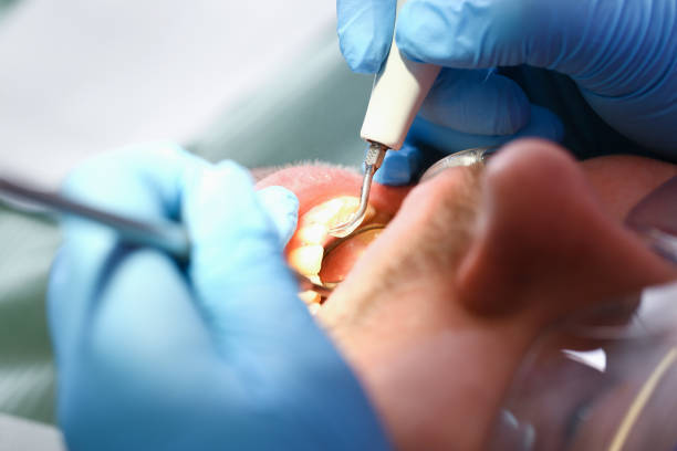 Best Emergency Denture Repair in Bradford, RI