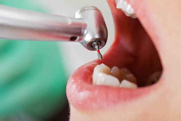 Best Emergency Treatment for Dental Infections or Abscesses in Bradford, RI